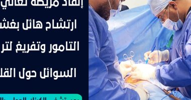 إنقاذ مريضة تعانى من ارتشاح كبير بغشاء التامور حول القلب بمستشفى الكرنك