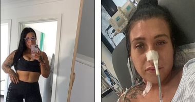 هوس عمليات التجميل يتسبب فى كوارث.. أسترالية أجرت عملية شد بطن فأصيبت بمرض "آكل اللحم".. فتاة تنفق 600 ألف دولار لتشبه كيم كاردشيان والنتيجة صادمة.. وشاب بريطانى ينفق 30 ألف جنيه إسترليني ليشبه "فلتر" إنستجرام