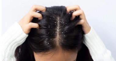 وصفات طبيعية لعلاج قشرة الشعر.. المكونات متوفرة فى بيتك