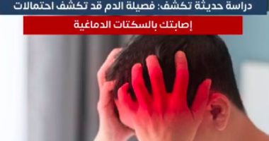 تفاصيل بحث علمى يكشف من فصيلة الدم فرص الإصابة بالسكتة الدماغية.. فيديو