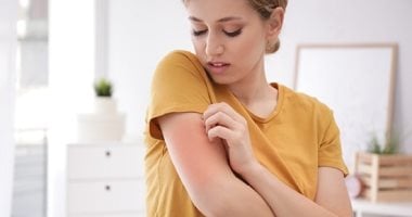 وصفات طبيعية لعلاج جلد الوزة.. من خل التفاح لحمام الشوفان