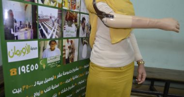 تضامن الأقصر تعلن تسليم 36 طرفا صناعيا للمستحقين.. صور
