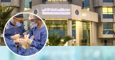 نجاح جراحة ميكروسكوبية دقيقة لزرع أصبع شاب بمجمع الإسماعيلية الطبى