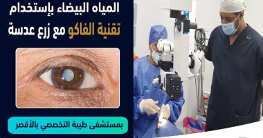 نجاح إجراء 10 عمليات لإزالة المياه البيضاء بالعين بمستشفى طيبة جنوب الأقصر