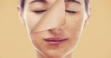 7 وصفات طبيعية لعلاج البشرة الجافة.. جوز الهند ودقيق الشوفان أبرزها