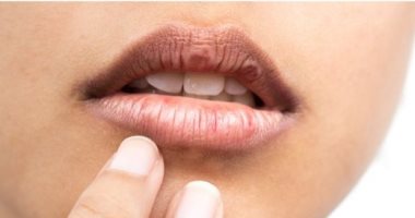 قبل الشتاء.. اعرفى طرق العناية الطبيعية بمنطقة حول الفم