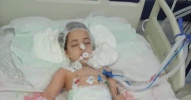 عضة كلب تهدد حياة طفلة 4 سنوات.. ووالدها يناشد بعلاجها فى الخارج