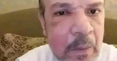 أحمد سلامة عن ضربه فى الشارع: شائعة.. وبكتيريا شرسة كادت تصل إلى المخ