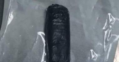 استخراج موبايل من معدة مريض بعد ابتلاعه بمستشفى المنصورة الدولى