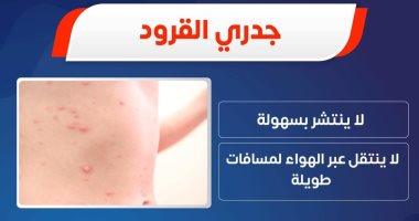 وزارة الصحة: جدرى القرود لا ينتقل عن طريق الهواء لمسافات طويلة