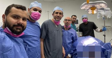 فريق جراحى بمستشفى قها التخصصي ينقذ حياة شاب تعرض لانفجار في الأمعاء