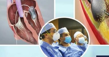 استمرار نجاحات وحدة القلب والقسطرة بمستشفى طيبة بإسنا.. اعرف التفاصيل