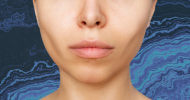 إزالة دهون الخدود أبرز عمليات التجميل لعام 2023.. اعرفى فوائدها وأضرارها