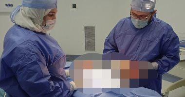 فريق جراحي بقها التخصصي يستأصل ورم من ظهر مريضة بالعقد السادس.. صور