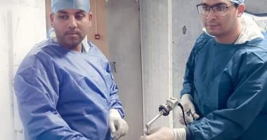 استخراج حصوة متشعبة فى حوض الكلى لمريض بمستشفى كفر الشيخ العام