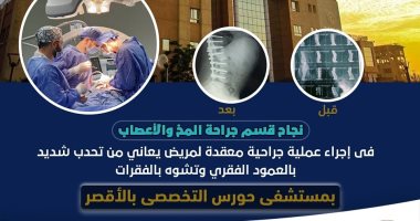 نجاح عملية معقدة لتحدب عمود فقرى وتشوه فقرات لمريض بمستشفى حورس بالأقصر
