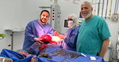 استئصال ورم يزن 5 كيلوجرامات من رحم سيدة في «إهناسيا التخصصي» ببني سويف