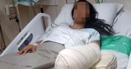  بتر يد سيدة برازيلية بعد الولادة بسبب خطأ طبى "صور"