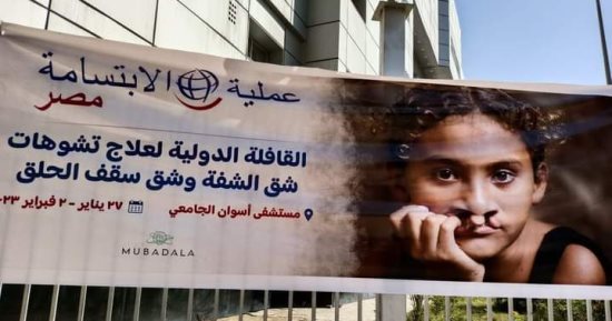 قافلة طبية مجانية لعلاج "الشفة الأرنبية" بمستشفيات جامعة أسوان