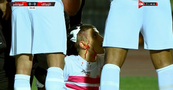 إصابة دامية لـ محمد عبد الغنى فى مباراة الزمالك وفيوتشر.. صور