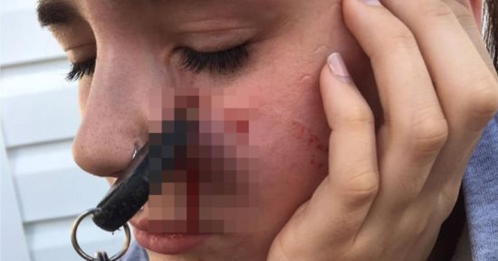 كندية حاولت التقاط مفتاح سيارتها من صديقها فاخترق وجهها بغرابة "صور"