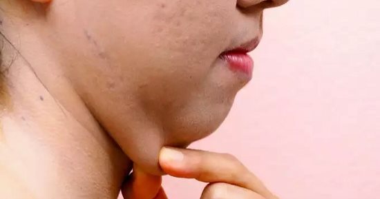 كونى جميلة فى كل حالاتك.. حيل بسيطة بالمكياج لإخفاء "اللغد"