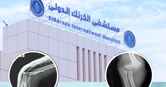 إنقاذ طفلة 5 سنوات من بتر بعد كسر عظمة العضد بمستشفى الكرنك بالأقصر