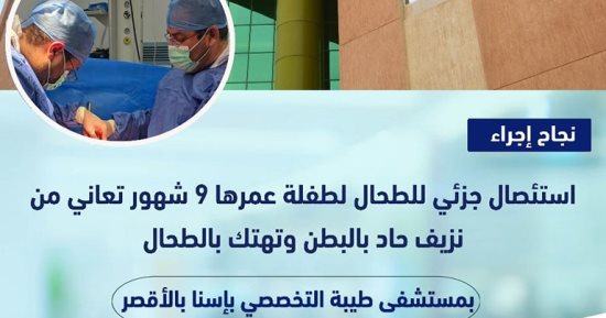 أطباء مستشفى طيبة ينجحون فى استئصال جزئى لطحال طفلة 9 شهور.. التفاصيل