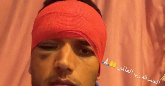 غنام محمد يكشف حجم إصابته فى الرأس بعد مواجهة بيراميدز