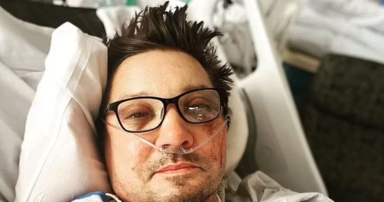 جيريمى رينر يخضع لجلسات علاج طبيعى بعد كسر 30 عظمة بجسده في حادث.. فيديو