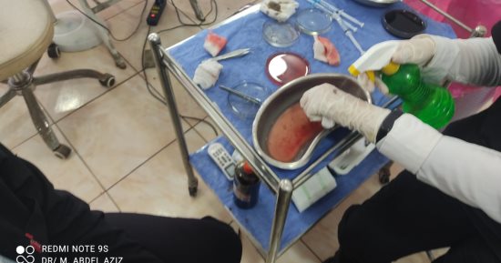 ضبط حاصل على دبلوم تجارة يدير مركزًا لزراعة الشعر بالمنصورة.. صور