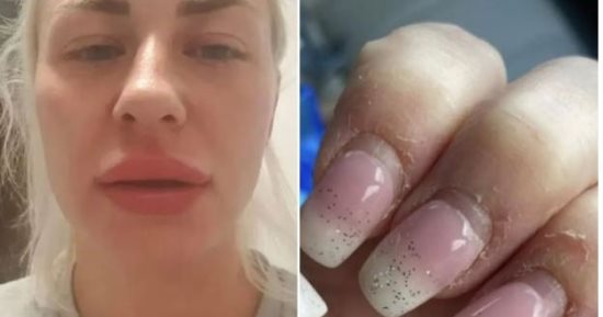 دخلت صالون التجميل للاعتناء بأظافرها.. فطلبوا لها الإسعاف