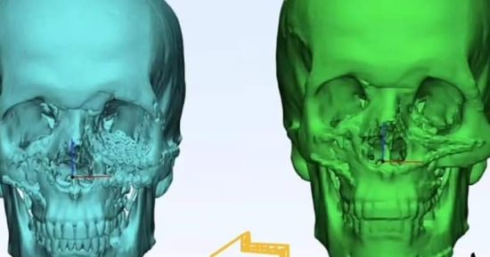 مستشفى "العجمى المركزى" تنجح فى إجراء عملية دقيقة بالوجه والفكين لأول مرة