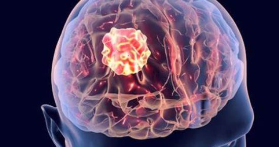 ابتكار دواء جديد يستخدم فى الطب الصينى التقليدى لعلاج سرطان المخ