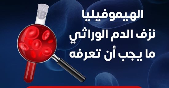 الصحة: البلازما العلاج الوحيد لمرضى الهيموفيليا