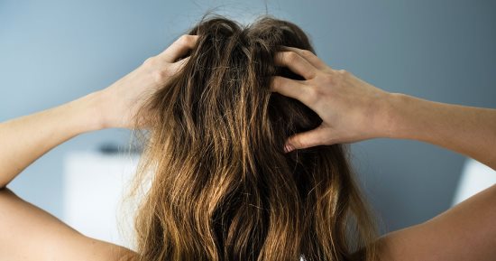 وصفات طبيعية للتخلص من قشرة الرأس.. خطوات سهلة ومكونات متوفرة
