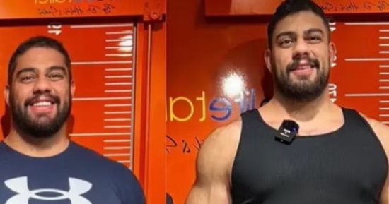 بعد شهور من العمليات المؤلمة.. شاب أمريكى يحقق الحلم ويزيد طوله 17 سم.. صور