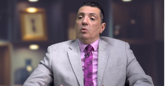 استشارى صحة نفسية: "مواقع التواصل عالم حقيقى ولكن ما نخدوش على أعصابنا"