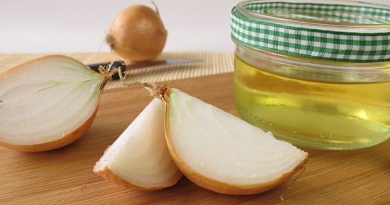 طرق مختلفة من عصير البصل للتخلص من قشرة الشعر.. بسيطة وسهلة 