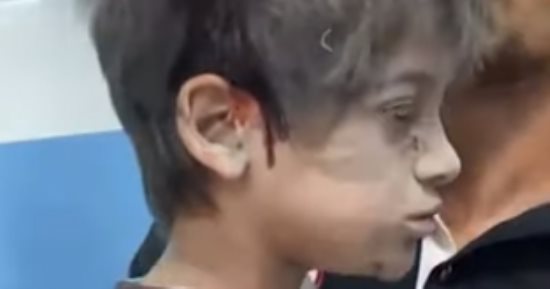 هذا ما جناه أطفال غزة.. رعب وموت وآلة حرب إسرائيلية تحصد الأرواح (فيديو)