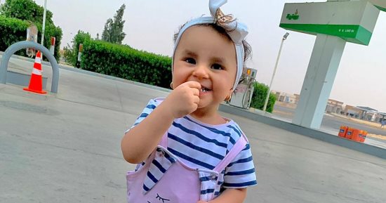 وما ذنب "ليلى".. طفلة نجت من الموت لتنضم لبطلات الحروق "صور"