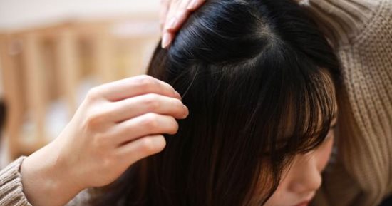 وصفات طبيعية لمقاومة الشيب المبكر.. من زيت جوز الهند لإكليل الجبل