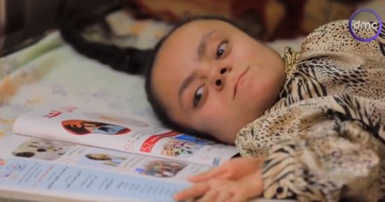 شروق مريضة العظم الزجاجي.. مكافحة من نوع خاص وحققت ما لم يستطعه الأصحاء