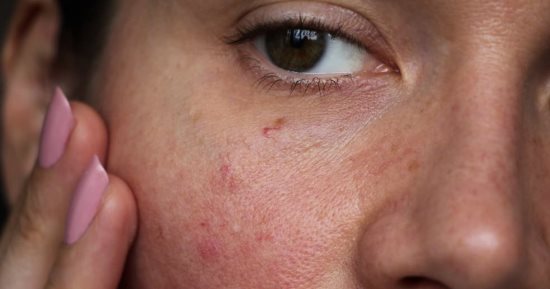 5 أشياء تدمر بشرتك بشكل خطير.. منها غسيل الوجه بطريقة خاطئة