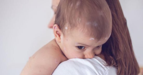 مش بزيادة الملابس.. اعرفى ازاى تدفى طفلك فى الشتا وتحمى جلده من الالتهابات
