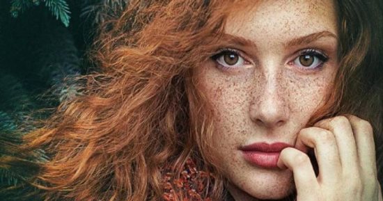 اطمن.. 5 علامات جلدية لا قلق منها أبرزها النمش
