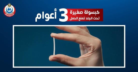 هل تعد "الكبسولة" وسيلة منع حمل آمنة؟.. استشارى نساء تجيب