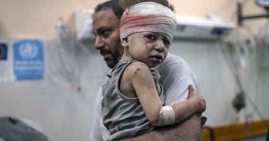 إسرائيل تقتل الفلسطينيين بأسلحة محرمة دوليا.. أطباء: الفوسفور أقوى من النار.. يأكل الجلد ويذيب اللحم ويخترق العظام.. الناجى يحيا "ميتا" داخل جسده المشوه.. وغاز الأعصاب شلل وهلوسة و"موت محقق"