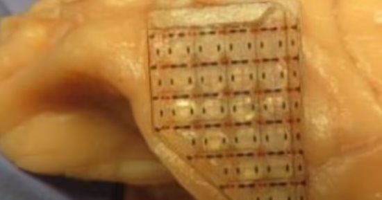 نهاية إدمان القمار.. علماء يطورون شريحة دماغية تقلل من المخاطرة
