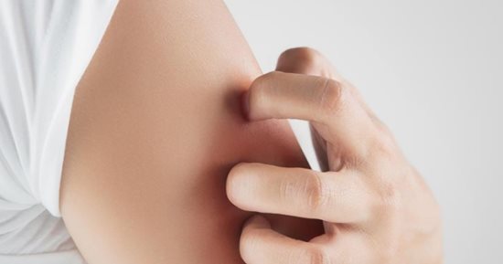 وصفات طبيعية للتخلص من جلد الوزة.. من زيت جوز الهند لصودا الخبز